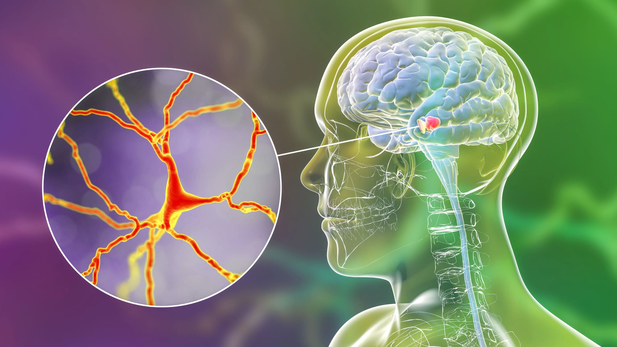 Nemoc, která ničí celé rodiny, konečně zpomalena. Až o 75 %