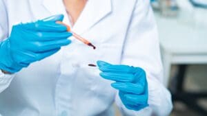 Alzheimerovu chorobu brzy objevíte doma. Stačí si píchnout do prstu