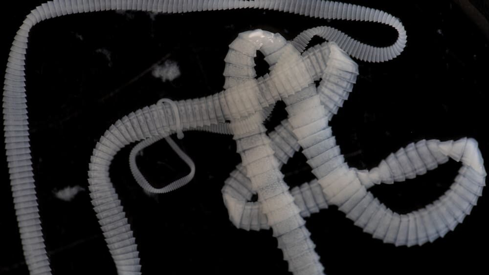 Živá lékárna v tenkém střevě. Nový objev slibuje konec neustálého braní pilulek