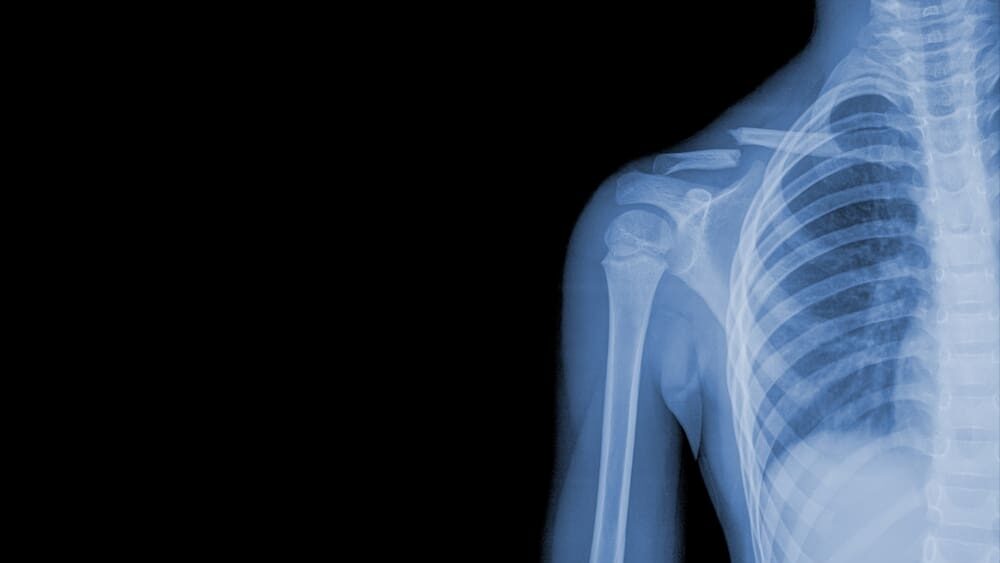 Rentgenové snímky z vesmíru uspěly. Novinka pomůže medicíně i opravám techniky