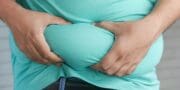 Každý šestý dospělý v EU má obezitu. Jedna země ale výrazně vyčnívá